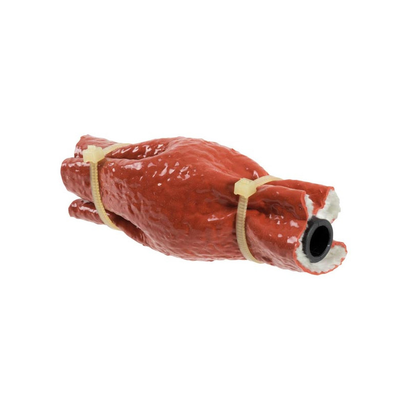 Dispositif blocage carburant 